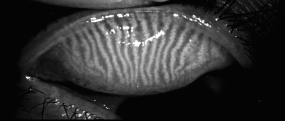 After Treatment